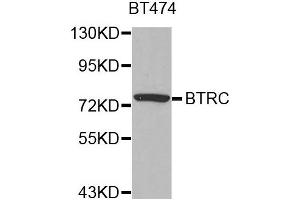 Western blot analysis of extracts of BT474 cell line, using BTRC antibody. (BTRC 抗体)