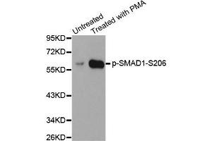 Western blot analysis of extracts from HeLa cells using Phospho-SMAD1-S206 antibody (ABIN2987857). (SMAD1 抗体  (pSer206))