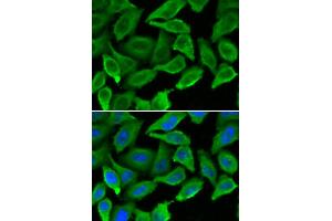 Immunofluorescence analysis of A549 cells using IFNA1 antibody (ABIN5970112).