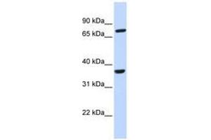 Image no. 1 for anti-Chemokine (C-C Motif) Receptor-Like 2 (CCRL2) (AA 36-85) antibody (ABIN6740363)