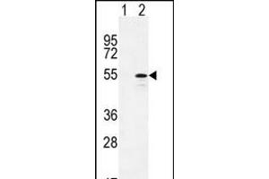 Western blot analysis of CYP26B1 (arrow) using rabbit polyclonal CYP26B1 Antibody (C-term) (ABIN392528 and ABIN2842083). (CYP26B1 抗体  (C-Term))