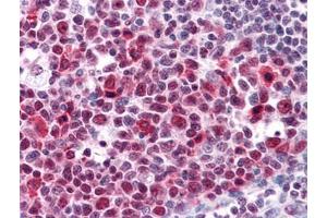 Immunohistochemistry (IHC) image for anti-High Mobility Group Box 2 (HMGB2) (AA 1-196) antibody (ABIN614619) (HMGB2 抗体  (AA 1-196))