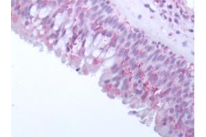 Immunohistochemistry (Paraffin-embedded Sections) (IHC (p)) image for anti-Olfactory Receptor, Family 10, Subfamily J, Member 5 (OR10J5) (Extracellular Domain) antibody (ABIN1049173)