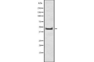 Western blot analysis of DUX4 using Jurkat whole cell lysates (DUX4 抗体)
