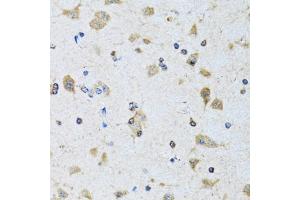 Immunohistochemistry of paraffin-embedded rat brain using PDP1 antibody (ABIN6132860, ABIN6145404, ABIN6145405 and ABIN6221944) at dilution of 1:100 (40x lens). (PDP 抗体  (AA 278-537))