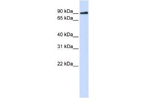 DCLRE1C antibody used at 1 ug/ml to detect target protein. (DCLRE1C 抗体)
