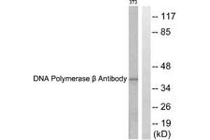Western blot analysis of extracts from NIH-3T3 cells, using DNA Polymerase beta Antibody.