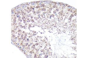 Immunohistochemistry (IHC) image for anti-Paternally Expressed 10 (PEG10) (AA 1-325) antibody (ABIN1681320)