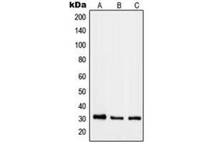 Western blot analysis of RAB40B expression in HeLa (A), mouse lung (B), rat heart (C) whole cell lysates. (RAB40B 抗体  (C-Term))