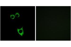 Immunofluorescence analysis of MCF7 cells, using VIPR2 Antibody. (VIPR2 抗体)