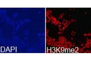 Immunofluorescence analysis of 293T cell using H3K9me2 antibody. (Histone 3 抗体  (H3K9me2))