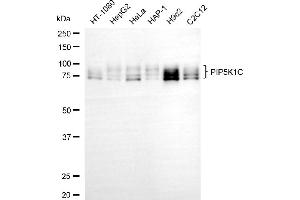 Western blotting analysis using PIP5K1C antibody (ABIN7799794).