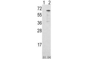 Western blot analysis of CAMKK1 antibody and 293 cell lysate either nontransfected (Lane 1) or transiently transfected with the CAMKK1 gene (2). (CAMKK1 抗体  (AA 337-369))