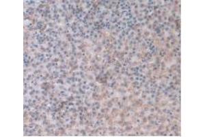 IHC-P analysis of Rat Adrenal Gland Tissue, with DAB staining. (ORM1 抗体  (AA 19-186))