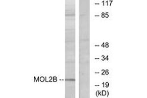 Western blot analysis of extracts from COLO cells, using MOBKL2B Antibody. (MOBKL2B 抗体  (AA 71-120))