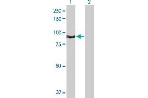 Western Blot analysis of TNNI3K expression in transfected 293T cell line by TNNI3K MaxPab polyclonal antibody. (TNNI3K 抗体  (AA 1-843))
