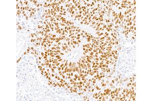 Immunohistochemistry (IHC) image for anti-MutS Homolog 6 (E. Coli) (MSH6) (AA 1310-1360) antibody (ABIN7455152)