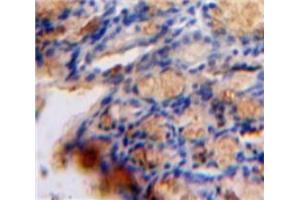 Used in DAB staining on fromalin fixed paraffin-embedded Bowels tissue (TGFB1I1 抗体  (AA 256-461))