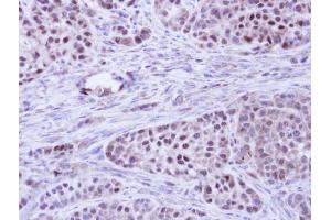 IHC-P Image Immunohistochemical analysis of paraffin-embedded A549 Xenograft, using BCL2L10, antibody at 1:100 dilution. (BCL2L10 抗体)