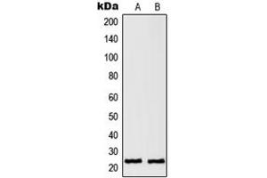 Western blot analysis of RAN expression in HeLa (A), A431 (B) whole cell lysates. (RAN 抗体  (C-Term))