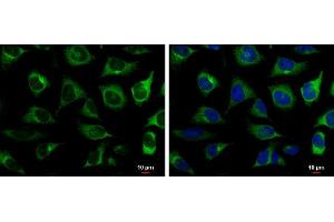 ICC/IF Image RRM2 antibody [N1C1] detects RRM2 protein at cytoplasm by immunofluorescent analysis. (RRM2 抗体  (Regulatory Subunit))