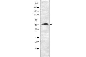 Western blot analysis of P4HTM using Jurkat whole cell lysates (P4HTM 抗体  (Internal Region))
