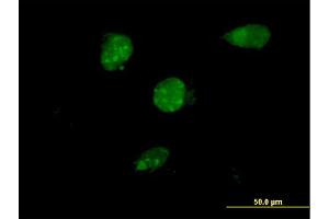 Immunofluorescence of monoclonal antibody to TSC22D4 on HeLa cell. (TSC22D4 抗体  (AA 1-395))