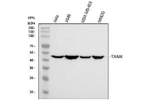 Western blot analysis of TANK using anti-TANK antibody (ABIN6719508). (TANK 抗体)