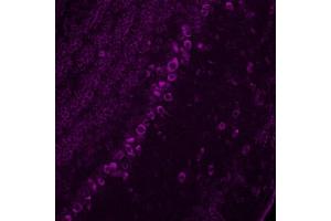 Immunohistochemistry (IHC) image for anti-Corticotropin Releasing Hormone (CRH) antibody (ABIN7456343) (CRH 抗体)