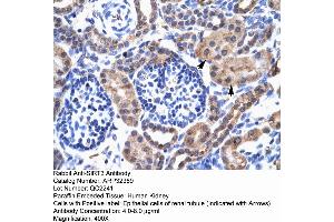 Human kidney (SIRT3 抗体  (C-Term))
