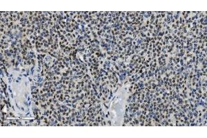 IHC analysis of PARP using anti-PARP antibody (ABIN7602278). (PARP1 抗体  (AA 670-858))