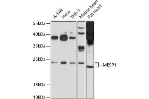 Western blot analysis of extracts of various cell lines, using MESP1 antibody (ABIN6131056, ABIN6143747, ABIN6143748 and ABIN6214298) at 1:1000 dilution. (MESP1 抗体  (AA 149-268))
