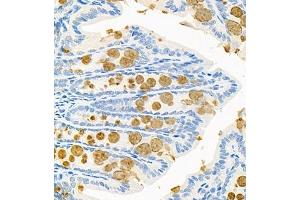 Immunohistochemistry of paraffin embedded mouse colon using CNTROB (ABIN7073427) at dilution of 1:200 (400x lens) (CNTROB 抗体)