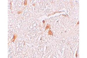 Immunohistochemistry (IHC) image for anti-Shisa Homolog 9 (Shisa9) (Middle Region) antibody (ABIN1031091) (Shisa9 抗体  (Middle Region))