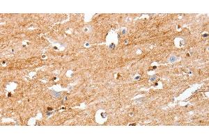 Immunohistochemistry of paraffin-embedded Human brain tissue using S100B Polyclonal Antibody at dilution 1:50 (S100B 抗体)