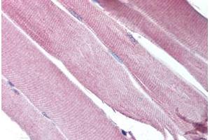 Human Skeletal Muscle (formalin-fixed, paraffin-embedded) stained with CHRND antibody ABIN213757 at 5 ug/ml followed by biotinylated goat anti-rabbit IgG secondary antibody ABIN481713, alkaline phosphatase-streptavidin and chromogen. (CHRND 抗体  (N-Term))