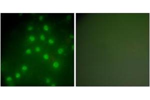 Immunofluorescence analysis of HepG2 cells, using HDAC9 Antibody. (HDAC9 抗体  (AA 1017-1066))