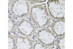 Immunohistochemistry of paraffin-embedded Human stomach using BCL2L2 Polyclonal Antibody at dilution of 1:100 (40x lens). (BCL2L2 抗体)