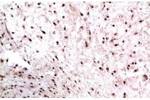 Immunohistochemistry of paraffin-embedded Human colon carcinoma tissue using CBX3 Monoclonal Antibody at dilution of 1:200. (CBX3 抗体)