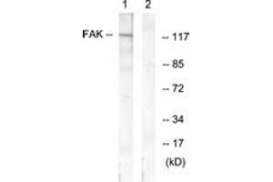 Western blot analysis of extracts from HeLa cells, treated with EGF 200ng/ml 30', using FAK (Ab-407) Antibody. (FAK 抗体  (AA 373-422))