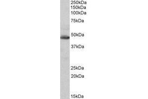 Western Blotting (WB) image for anti-Isocitrate Dehydrogenase 2 (NADP+), Mitochondrial (IDH2) (AA 418-429) antibody (ABIN1496056) (IDH2 抗体  (AA 418-429))