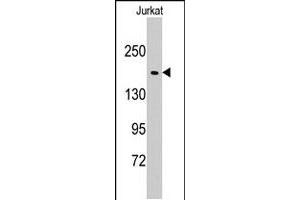 Western blot analysis of EPRS polyclonal antibody  in Jurkat cell line lysates (35 ug/lane). (EPRS 抗体  (N-Term))
