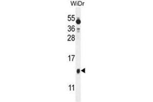 BEX1 Antibody (Center) western blot analysis in WiDr cell line lysates (35µg/lane). (BEX1 抗体  (Middle Region))