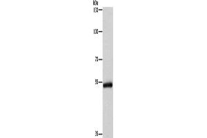 Western Blotting (WB) image for anti-Cytochrome P450, Family 2, Subfamily B, Polypeptide 6 (CYP2B6) antibody (ABIN2432914) (CYP2B6 抗体)