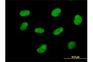 Immunofluorescence of purified MaxPab antibody to CDK7 on HeLa cell. (CDK7 抗体  (AA 1-346))