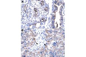 Immunohistochemical staining (Formalin-fixed paraffin-embedded sections) of human lung (A) and human liver (B) with HTATIP2 polyclonal antibody  at 4-8 ug/mL working concentration. (HIV-1 Tat Interactive Protein 2, 30kDa (HTATIP2) (N-Term) 抗体)