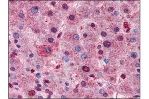 AP22624PU-N AKT antibody staining of Formalin-Fixed Paraffin-Embedded Human Liver at 1/100 followed by Biotin conjugated Goat anti-Rabbit IgG secondary antibody, Alkaline Phosphatase-Streptavidin and Chromogen. (AKT1 抗体  (C-Term))