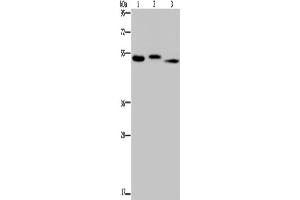 Western Blotting (WB) image for anti-Hyaluronidase-3 (HYAL3) antibody (ABIN2423631) (HYAL3 抗体)