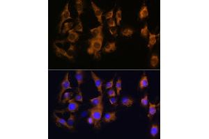 Immunofluorescence analysis of C6 using SPRR3 antibody (ABIN6130714, ABIN6148386, ABIN6148387 and ABIN6215609) at dilution of 1:100 (40x lens).