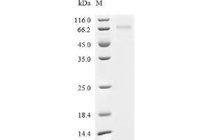 (Tris-Glycine gel) Discontinuous SDS-PAGE (reduced) with 5 % enrichment gel and 15 % separation gel.